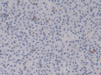 Monoclonal Antibody to Heat Shock Protein Beta 6 (HSPb6)