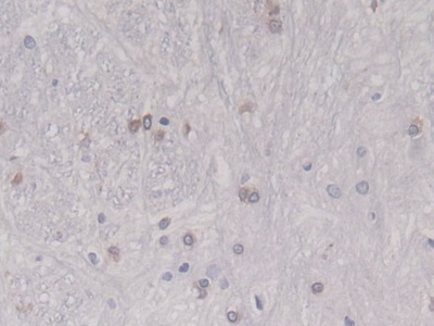 Monoclonal Antibody to Heat Shock Protein Beta 6 (HSPb6)