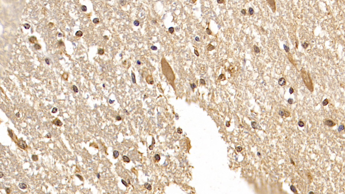 Monoclonal Antibody to Doublecortin Like Kinase 1 (DCLK1)