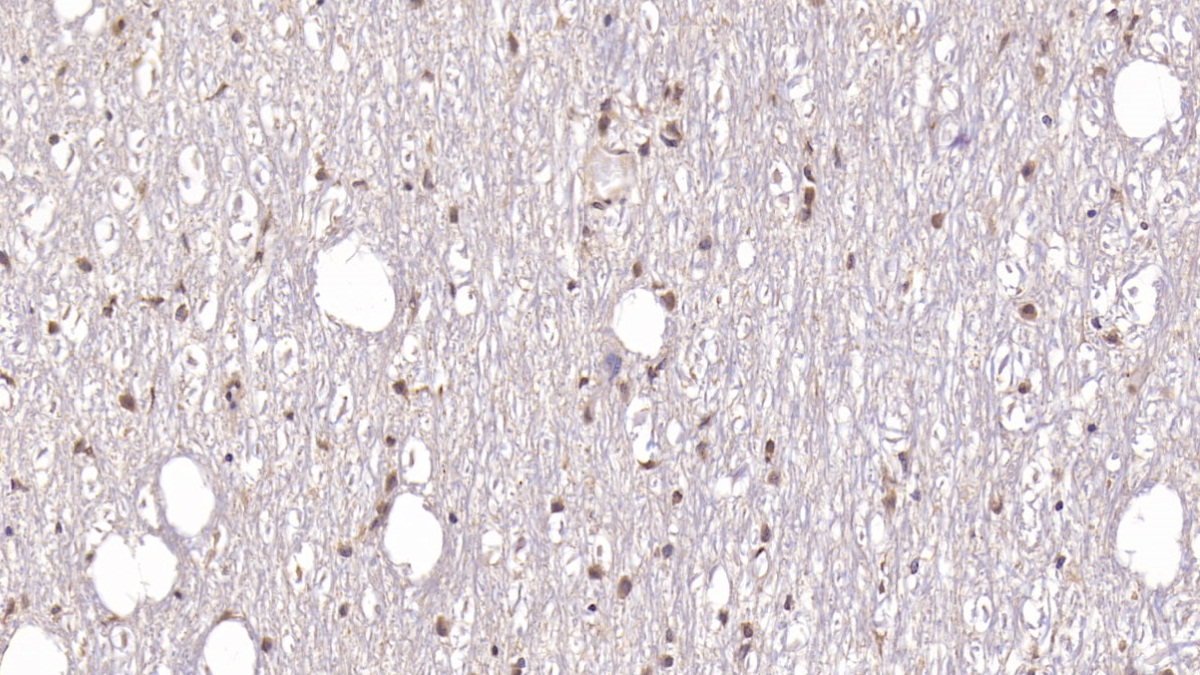 Monoclonal Antibody to Doublecortin Like Kinase 1 (DCLK1)