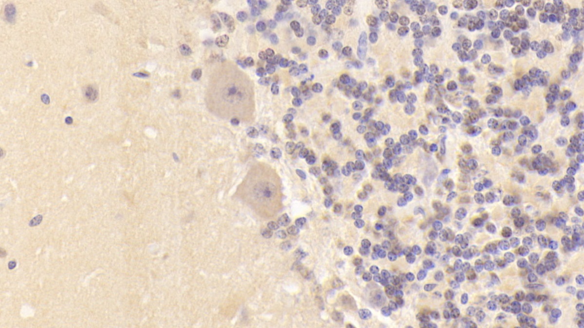 Monoclonal Antibody to Doublecortin Like Kinase 1 (DCLK1)