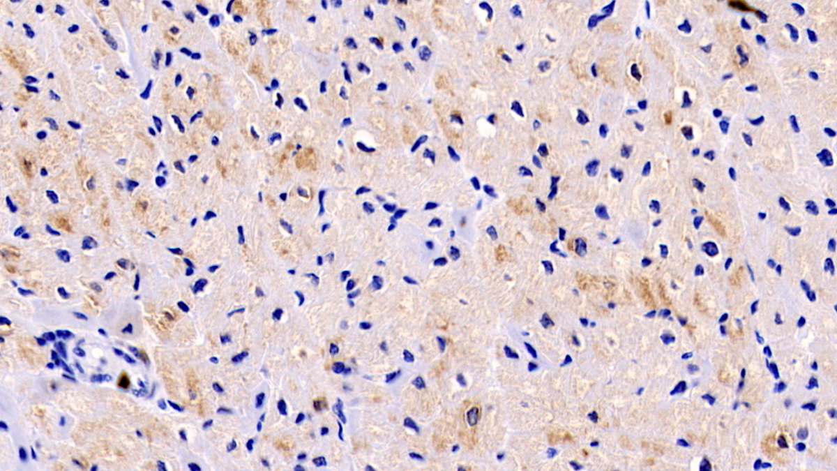 Monoclonal Antibody to Lysyl Oxidase Like Protein 1 (LOXL1)