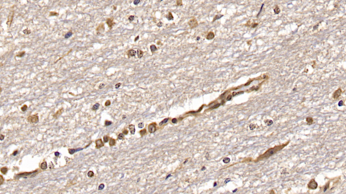 Monoclonal Antibody to 2',5'-Oligoadenylate Synthetase 2 (OAS2)