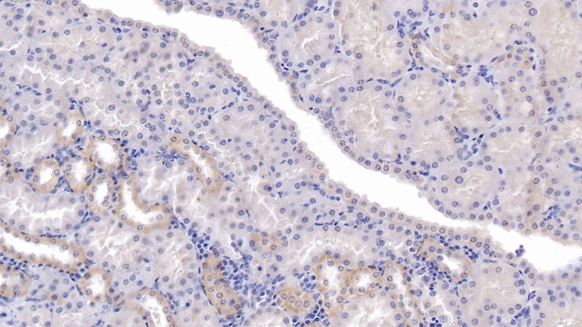 Monoclonal Antibody to Secreted Frizzled Related Protein 1 (SFRP1)