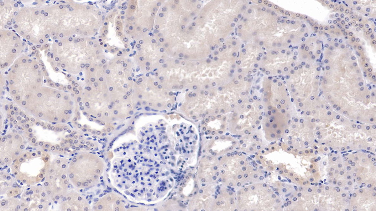 Monoclonal Antibody to Secreted Frizzled Related Protein 1 (SFRP1)