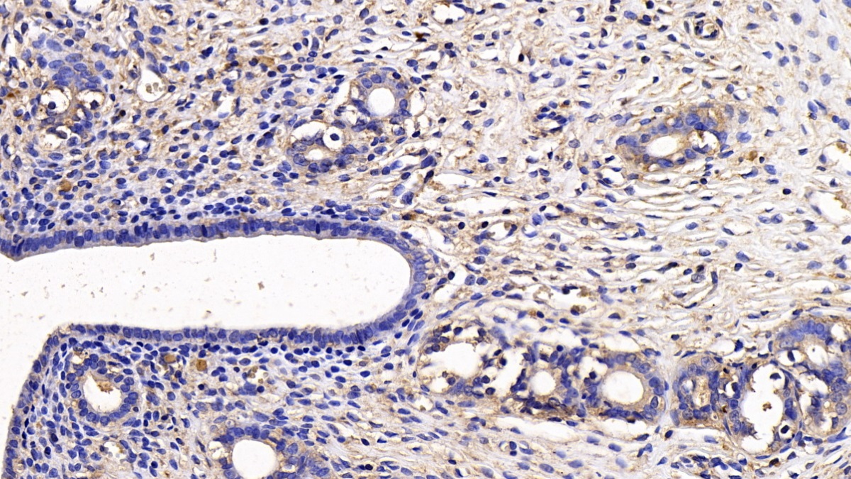 Monoclonal Antibody to Secreted Frizzled Related Protein 1 (SFRP1)