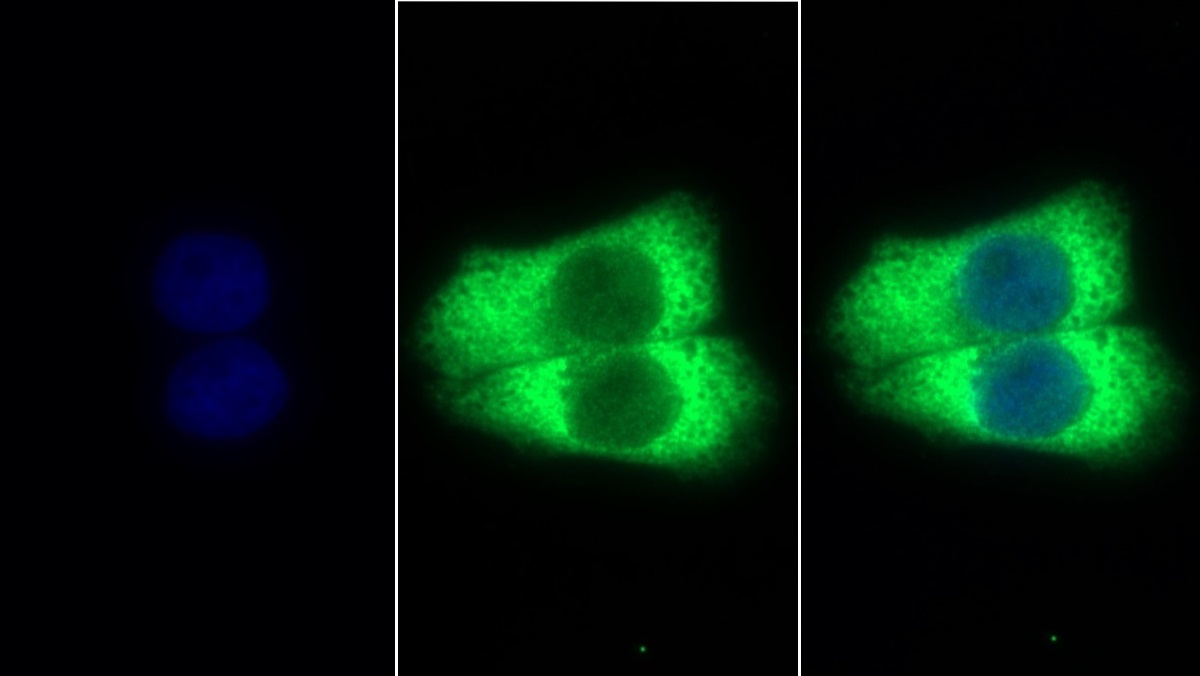 Monoclonal Antibody to Stanniocalcin 2 (STC2)