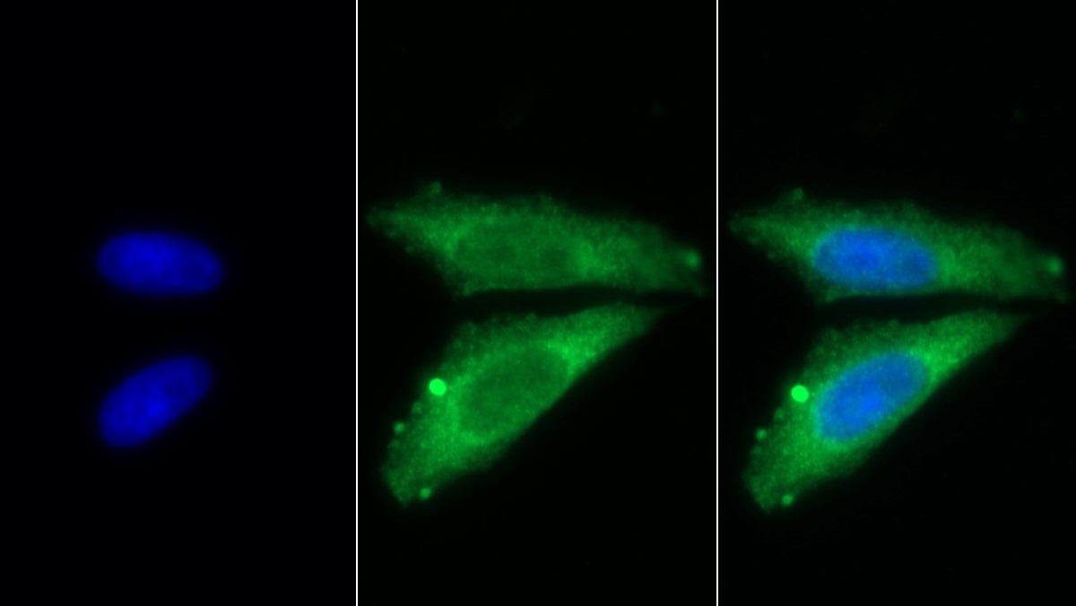 Monoclonal Antibody to Stanniocalcin 2 (STC2)