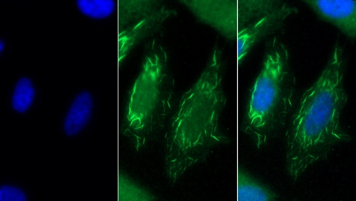 Monoclonal Antibody to Stanniocalcin 2 (STC2)