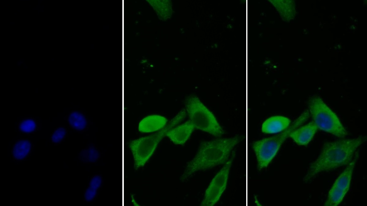 Monoclonal Antibody to Stanniocalcin 2 (STC2)