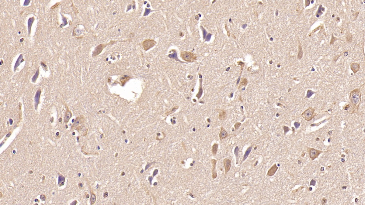 Monoclonal Antibody to Aspartate Beta Hydroxylase (ASPH)