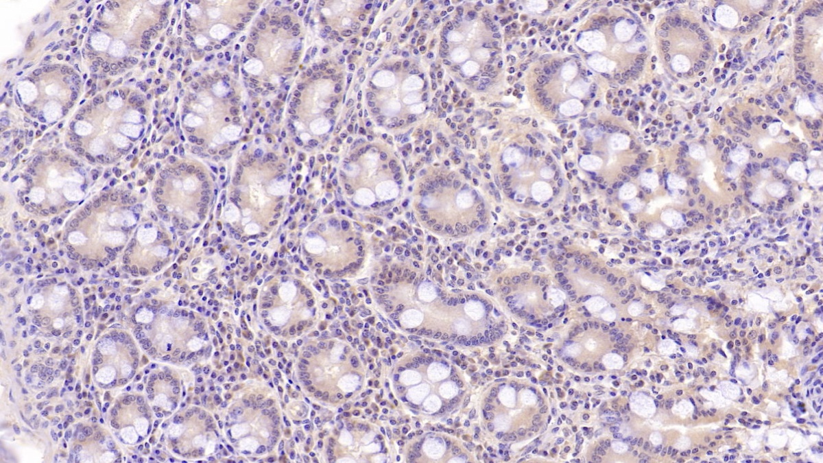 Monoclonal Antibody to Aspartate Beta Hydroxylase (ASPH)