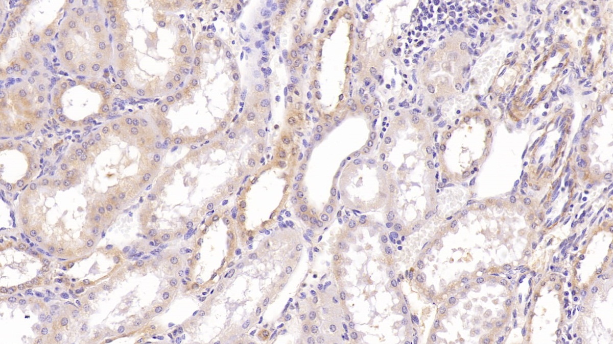 Monoclonal Antibody to Aspartate Beta Hydroxylase (ASPH)