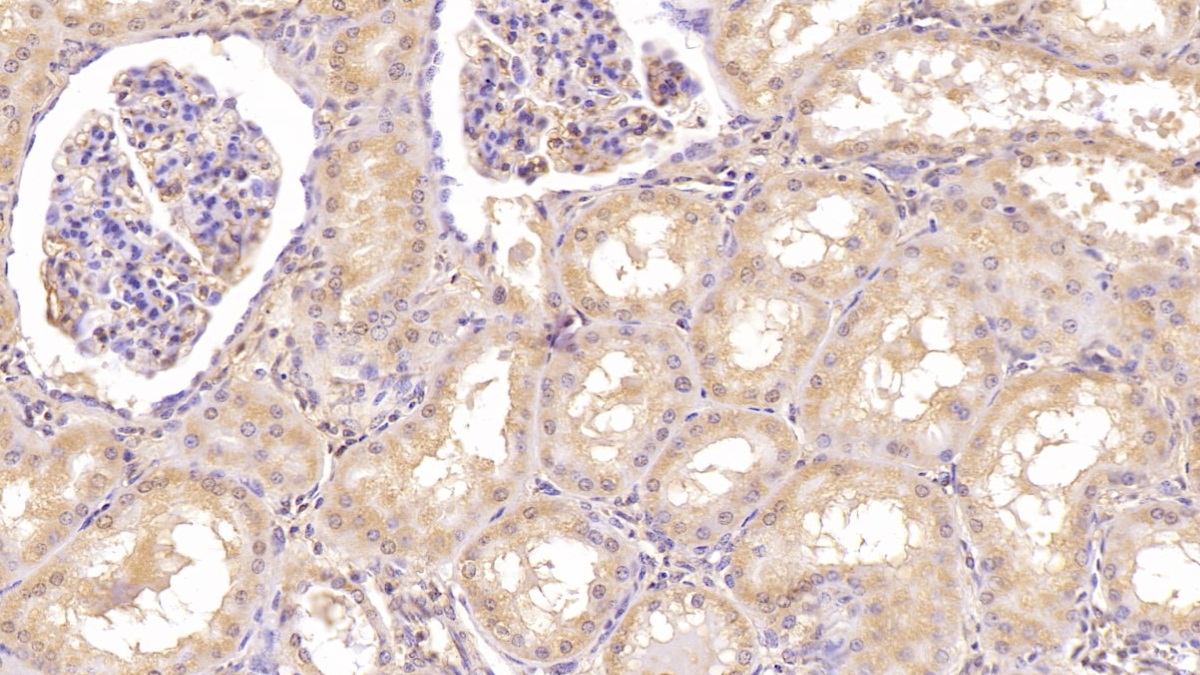 Monoclonal Antibody to Aspartate Beta Hydroxylase (ASPH)