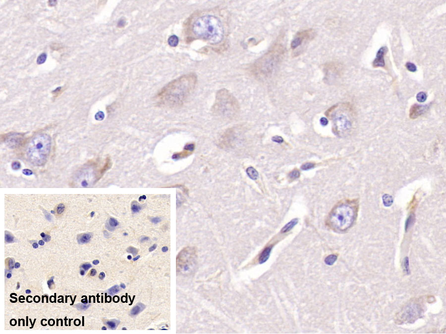 Monoclonal Antibody to Aspartate Beta Hydroxylase (ASPH)