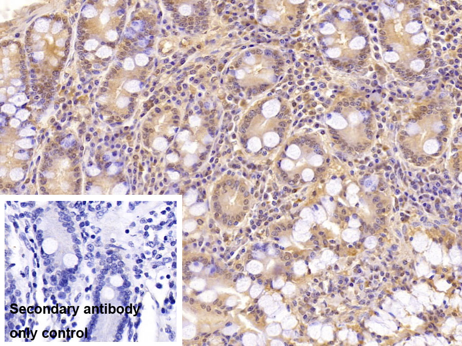 Monoclonal Antibody to Aspartate Beta Hydroxylase (ASPH)