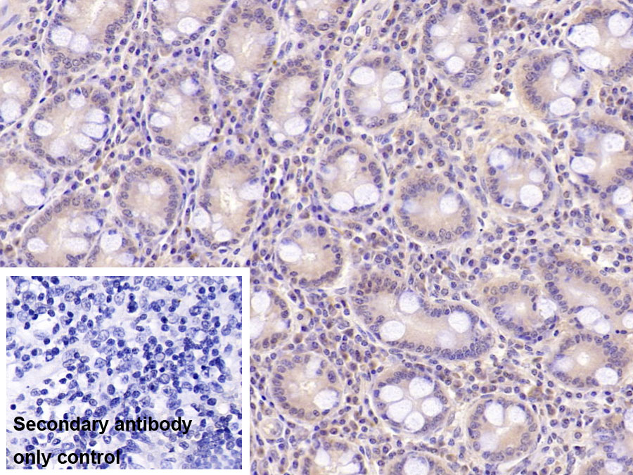 Monoclonal Antibody to Aspartate Beta Hydroxylase (ASPH)