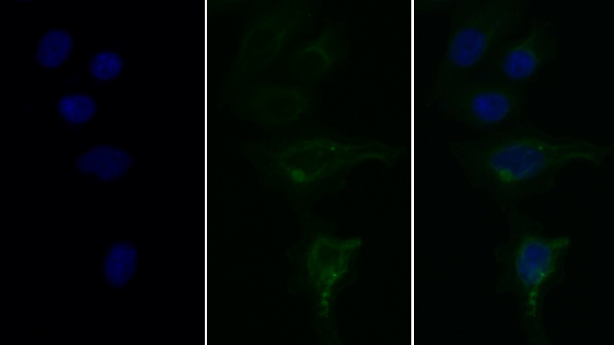 Monoclonal Antibody to Statherin (STATH)