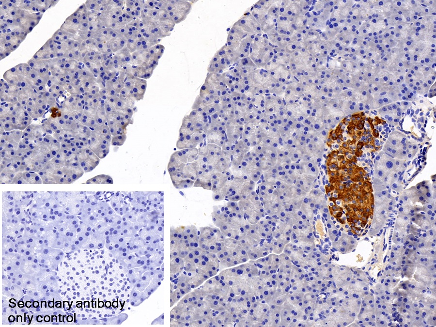 Monoclonal Antibody to Transcobalamin II, Macrocytic Anemia (TCN2)