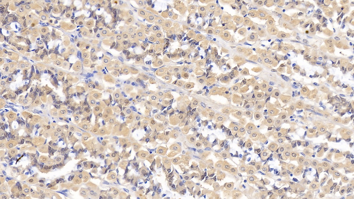 Monoclonal Antibody to Interferon Alpha 21 (IFNa21)