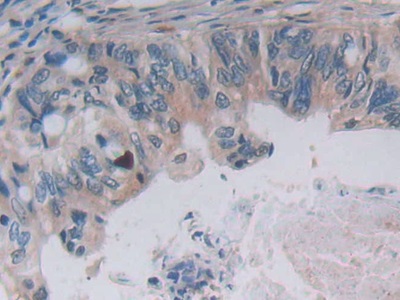 Monoclonal Antibody to Interferon Alpha 5 (IFNa5)