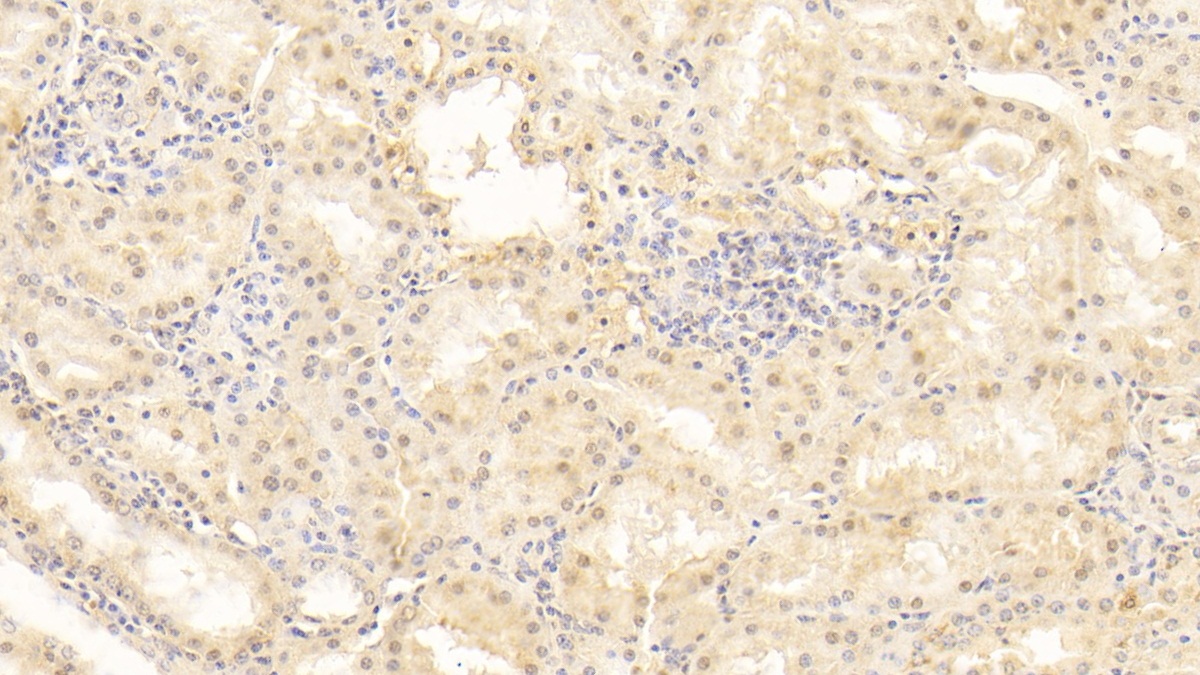 Monoclonal Antibody to Periostin (POSTN)