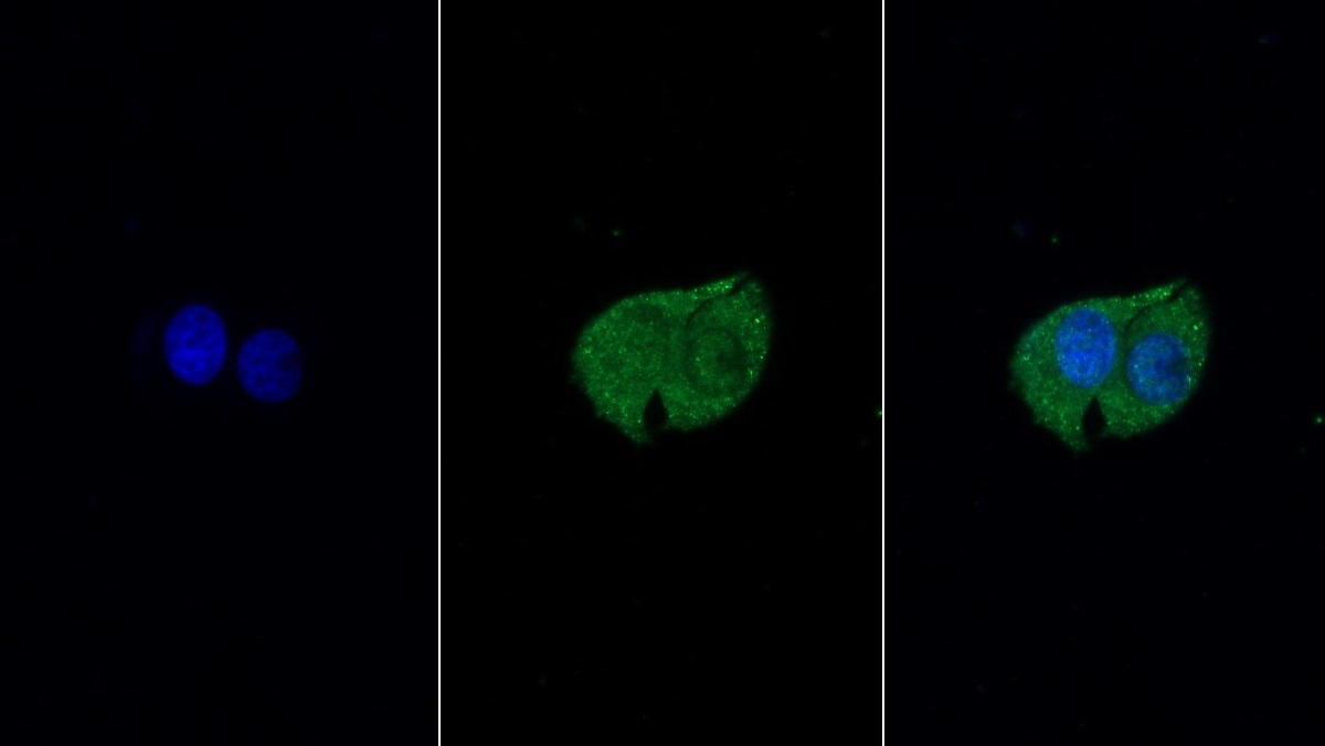 Monoclonal Antibody to Plastin 3 (PLS3)