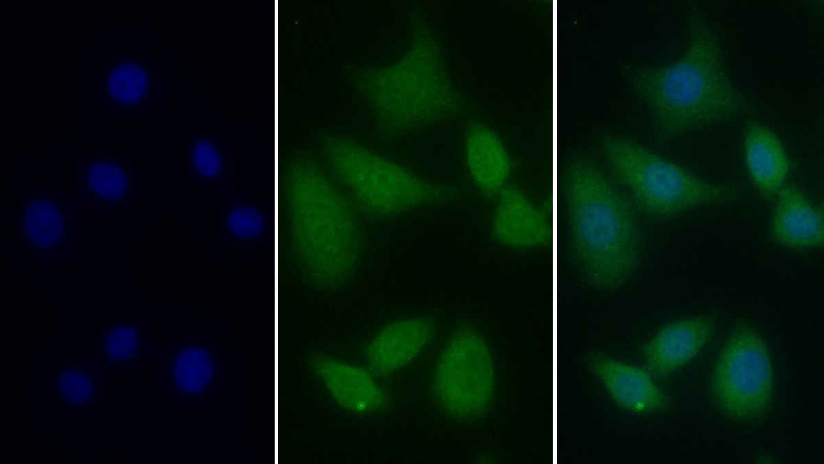 Monoclonal Antibody to Plastin 3 (PLS3)