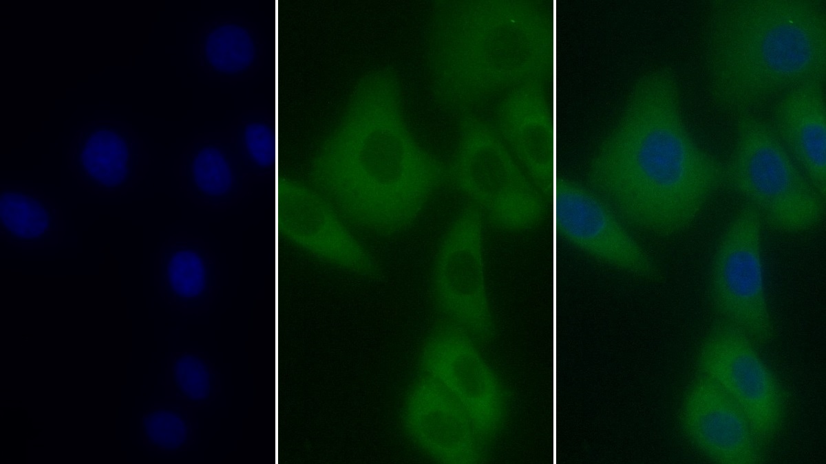 Monoclonal Antibody to Plastin 3 (PLS3)