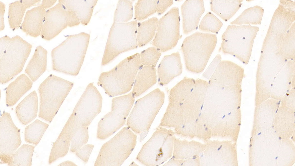 Monoclonal Antibody to Mesothelin (MSLN)