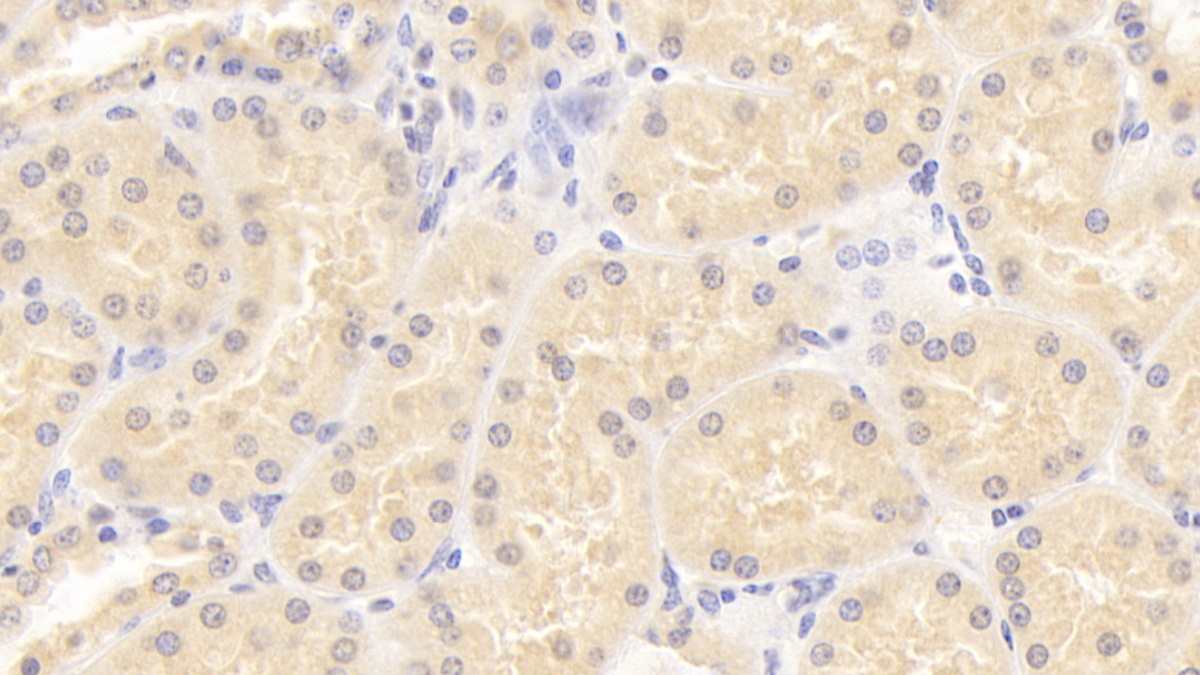 Monoclonal Antibody to Immunoglobulin Superfamily Containing Leucine Rich Repeat Protein (ISLR)