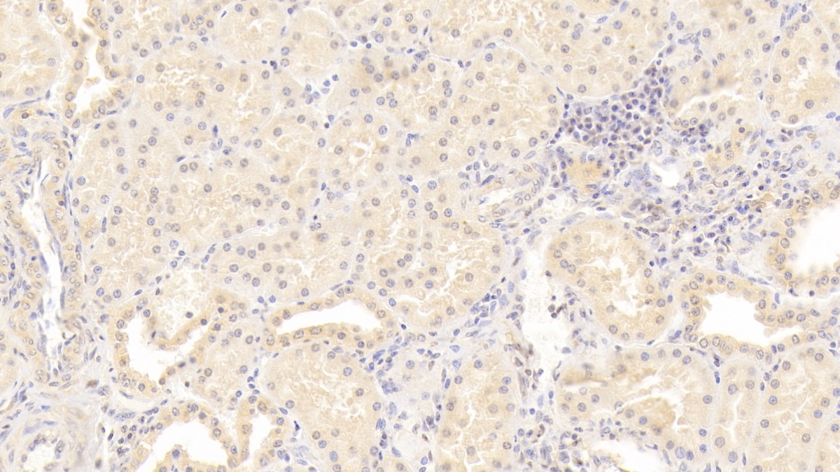 Monoclonal Antibody to Immunoglobulin Superfamily Containing Leucine Rich Repeat Protein (ISLR)