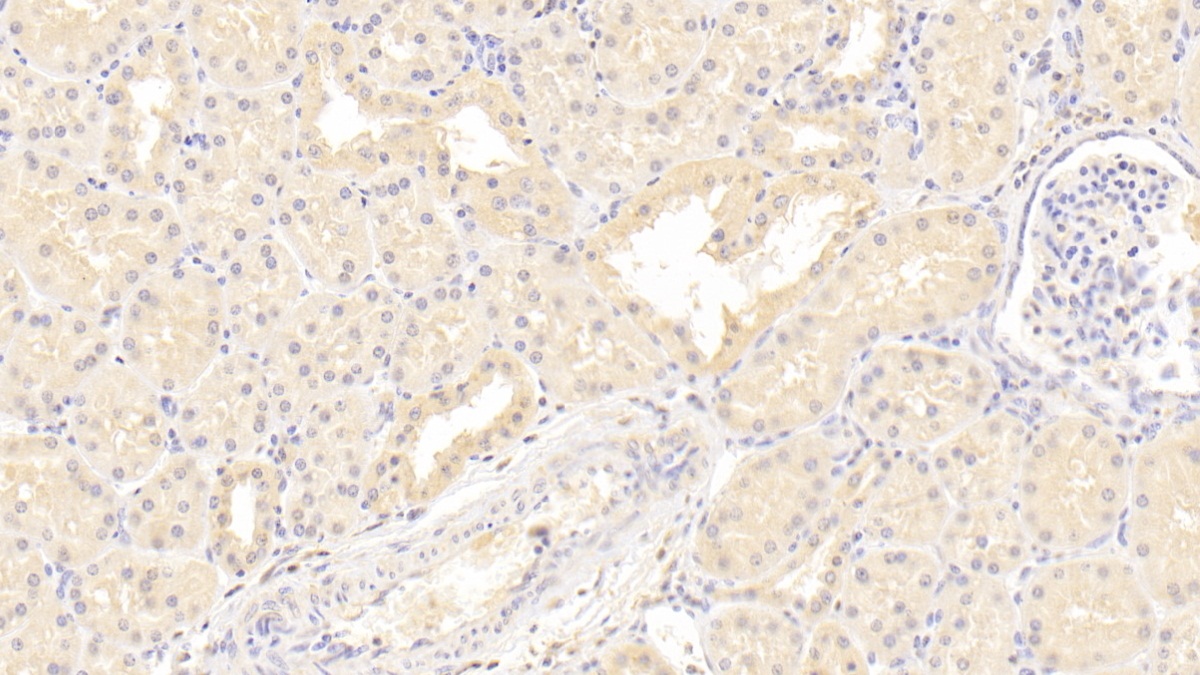 Monoclonal Antibody to Immunoglobulin Superfamily Containing Leucine Rich Repeat Protein (ISLR)