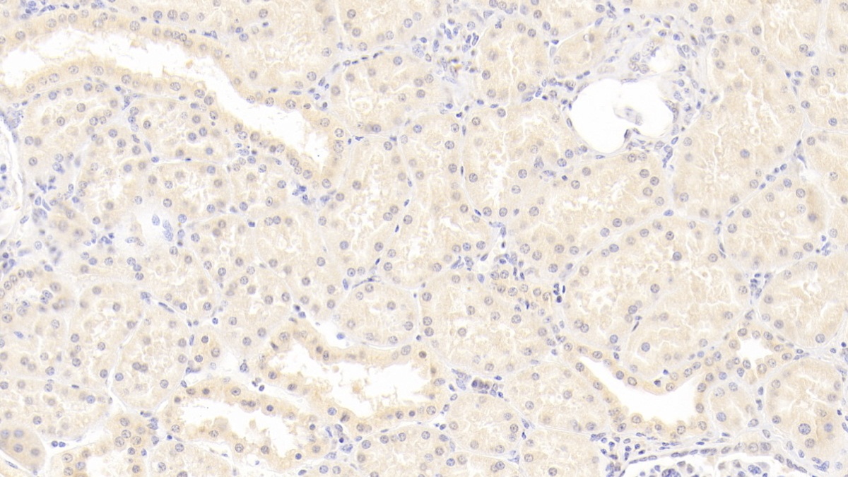 Monoclonal Antibody to Immunoglobulin Superfamily Containing Leucine Rich Repeat Protein (ISLR)