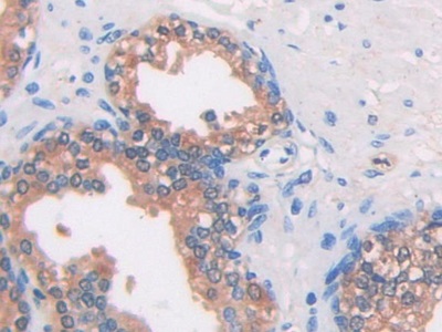 Monoclonal Antibody to Isocitrate Dehydrogenase 1, Soluble (IDH1)