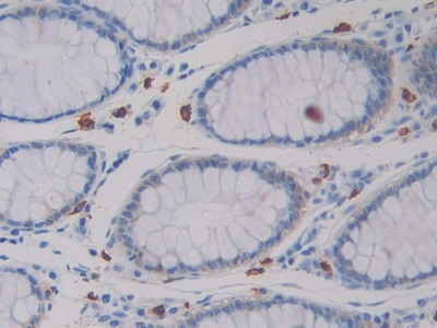 Monoclonal Antibody to Isocitrate Dehydrogenase 1, Soluble (IDH1)