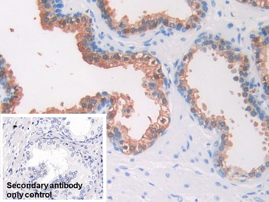 Monoclonal Antibody to Isocitrate Dehydrogenase 1, Soluble (IDH1)