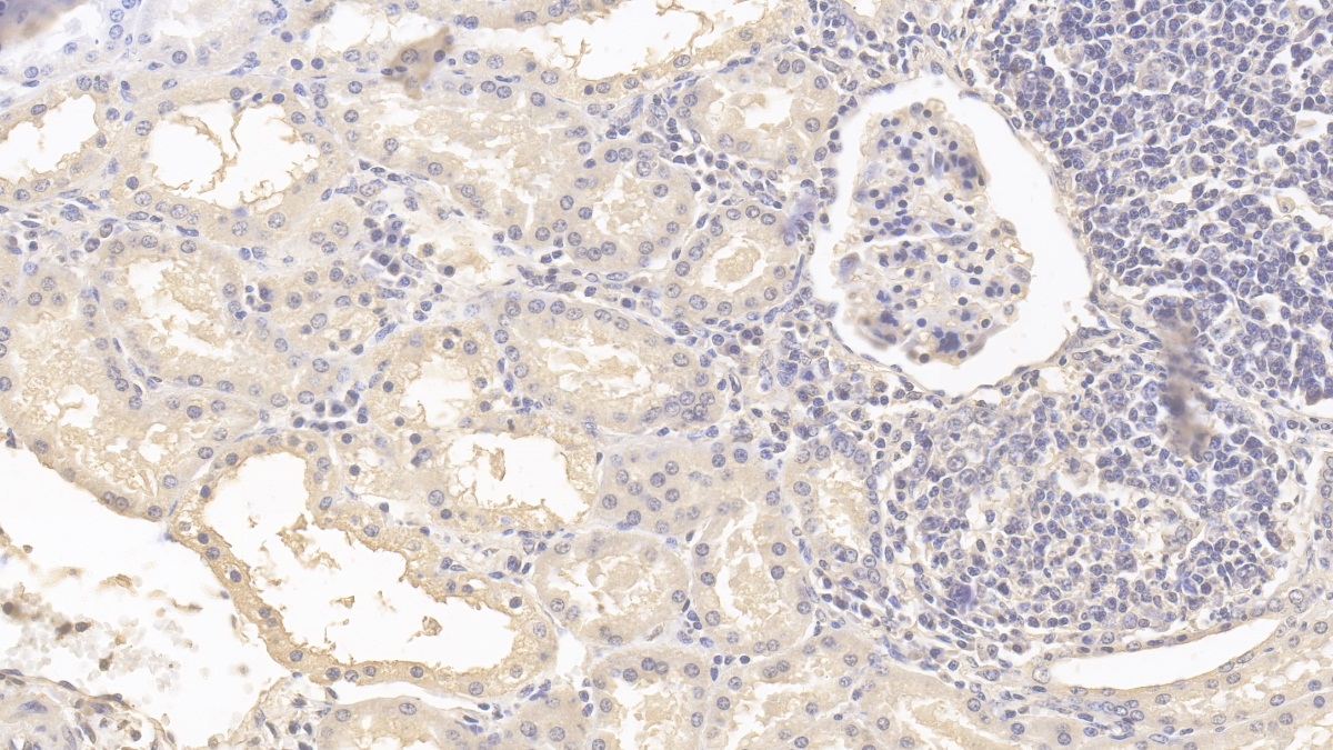 Monoclonal Antibody to Fission 1 (FIS1)