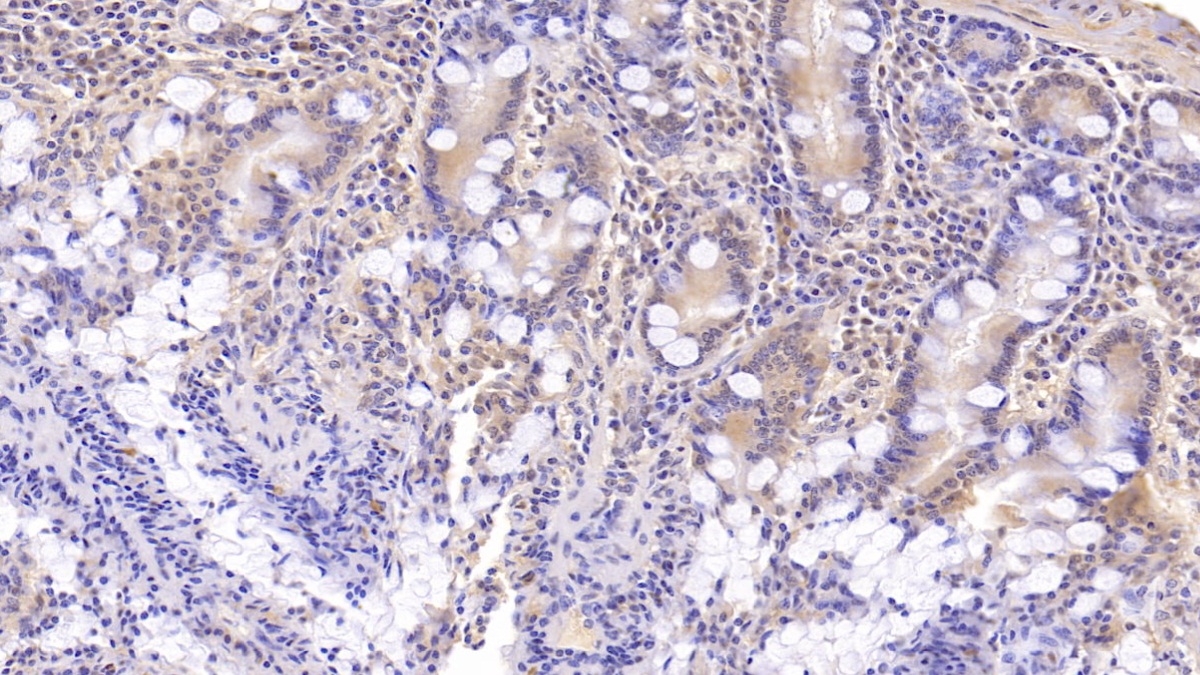 Monoclonal Antibody to Dynein, Axonemal, Heavy Chain 11 (DNAH11)