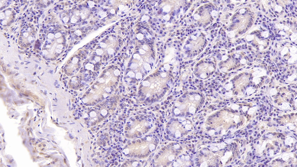 Monoclonal Antibody to Dynein, Axonemal, Heavy Chain 11 (DNAH11)