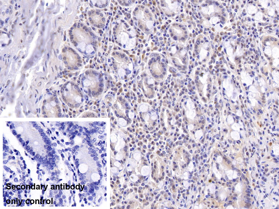 Monoclonal Antibody to Dynein, Axonemal, Heavy Chain 11 (DNAH11)