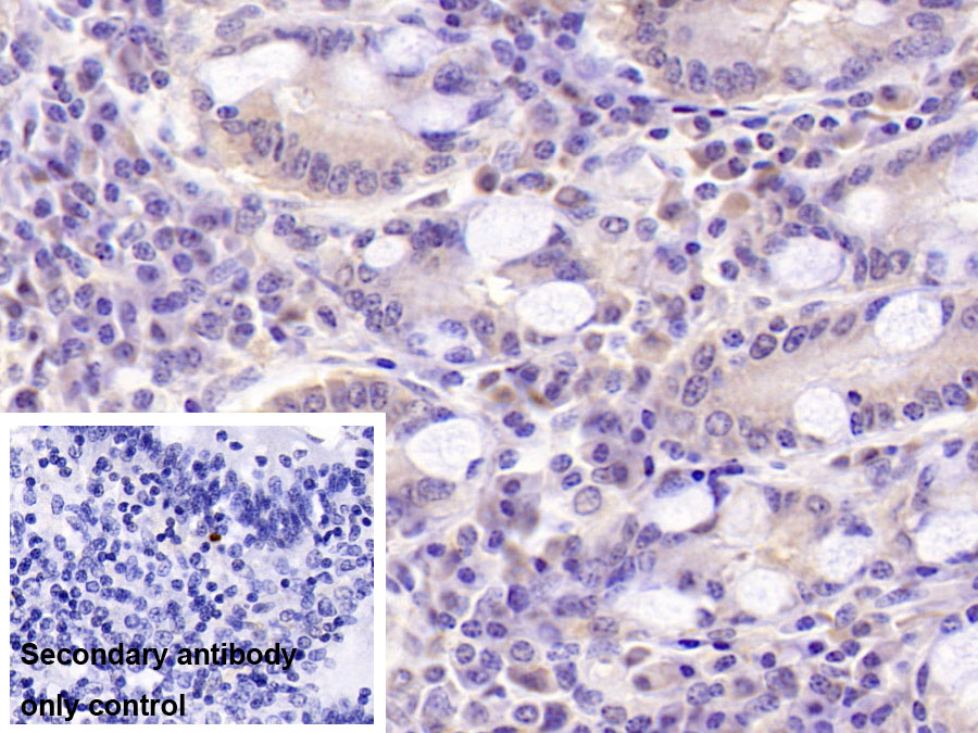 Monoclonal Antibody to Dynein, Axonemal, Heavy Chain 11 (DNAH11)