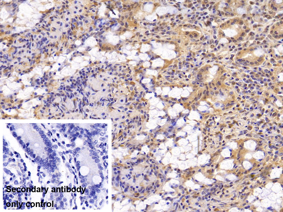 Monoclonal Antibody to Dynein, Axonemal, Heavy Chain 11 (DNAH11)