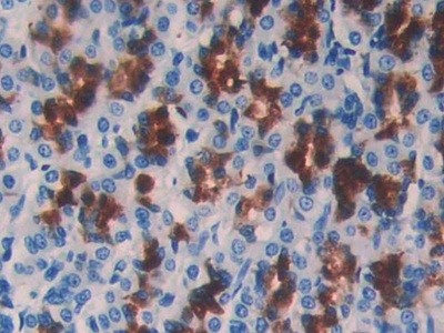 Monoclonal Antibody to Cystatin B (CSTB)