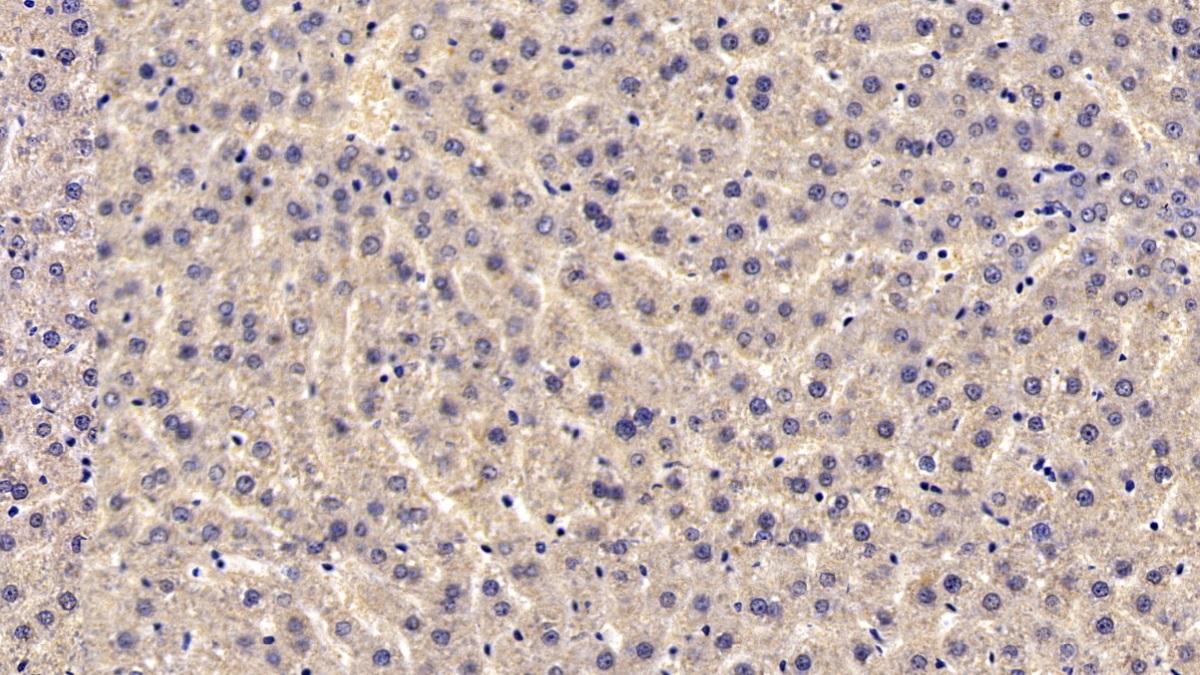 Monoclonal Antibody to Catechol-O-Methyltransferase (COMT)