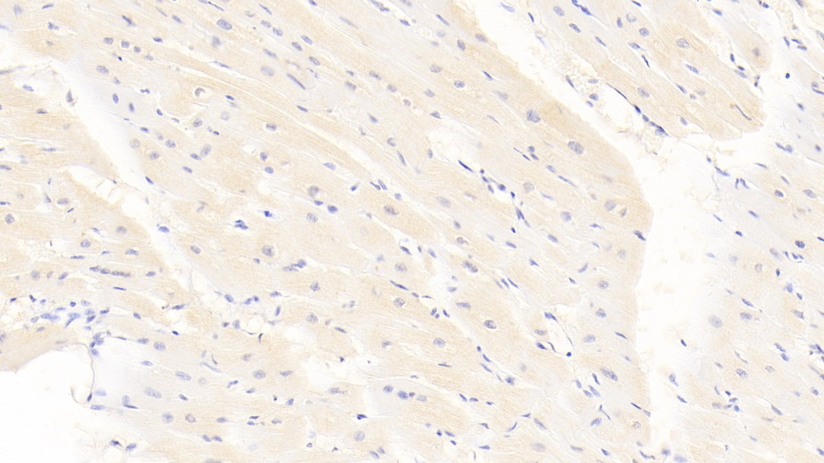 Monoclonal Antibody to Calponin 2 (CNN2)