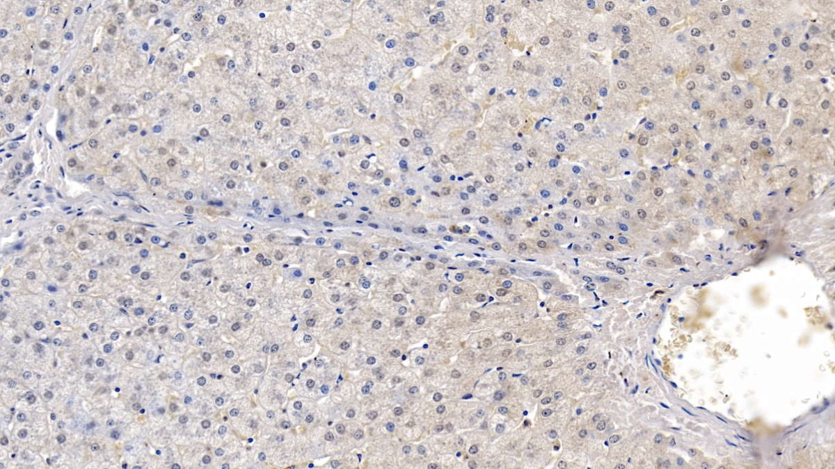 Monoclonal Antibody to Lecithin Cholesterol Acyltransferase (LCAT)