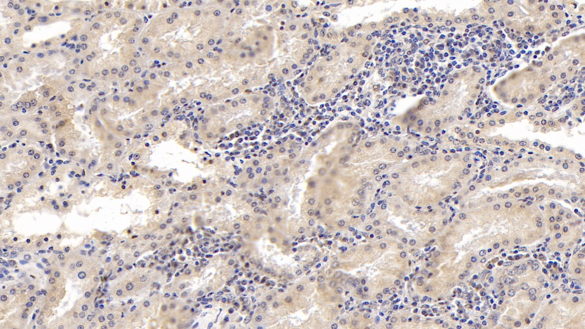 Monoclonal Antibody to Lecithin Cholesterol Acyltransferase (LCAT)