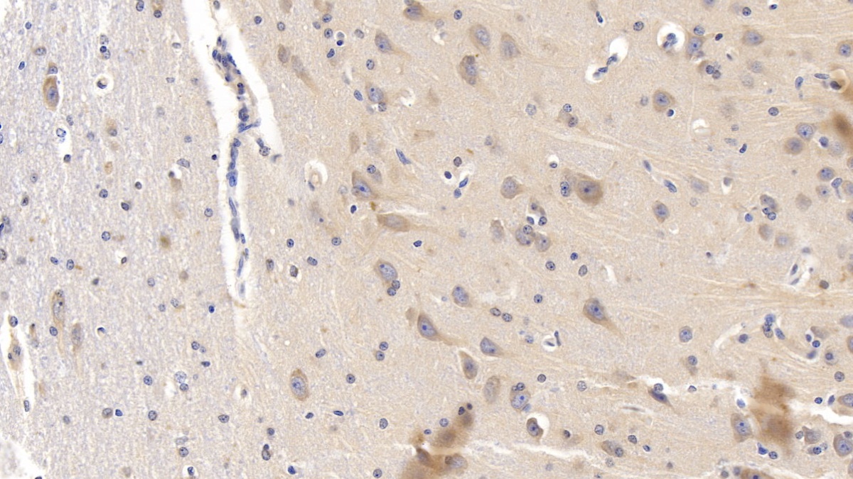 Monoclonal Antibody to Lecithin Cholesterol Acyltransferase (LCAT)