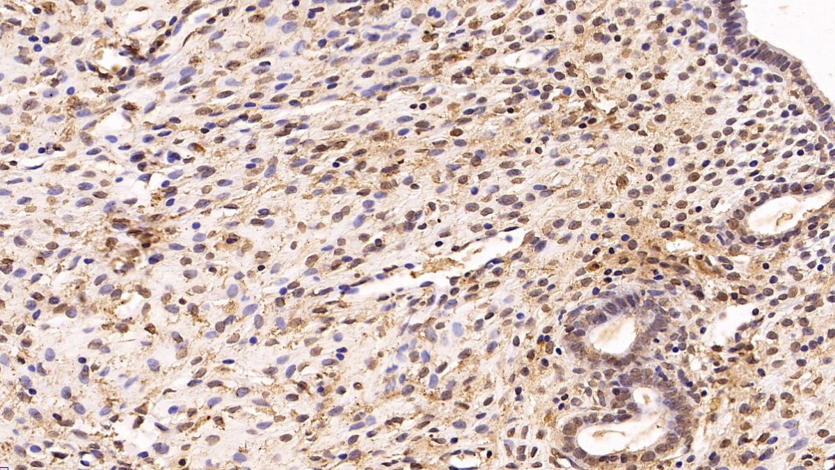 Monoclonal Antibody to Von Hippel Lindau Tumor Suppressor (vHL)